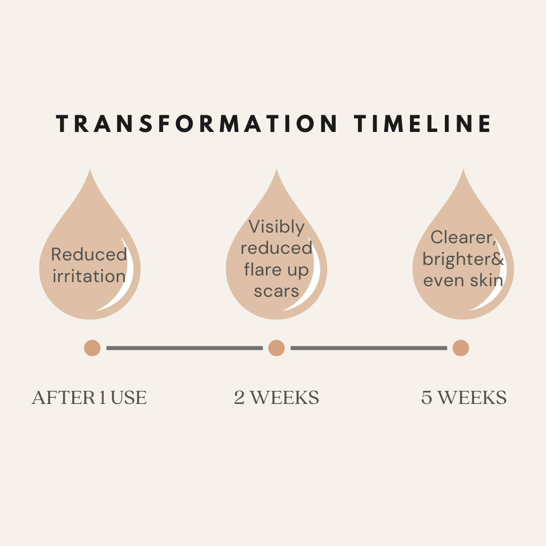 Stress Relief: Spearmint Eucalyptus Soap