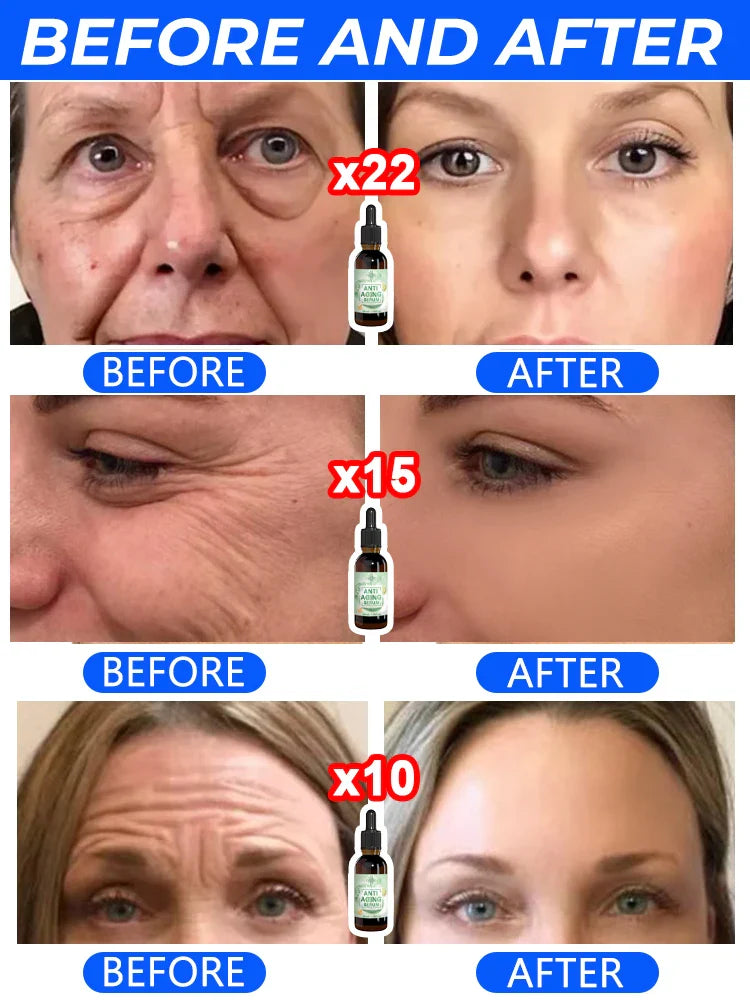 Wrinkle Hitman 100X — Liquid Anti-Aging Serum for Eyes, Face & Neck (Hollywood-Grade Formula)