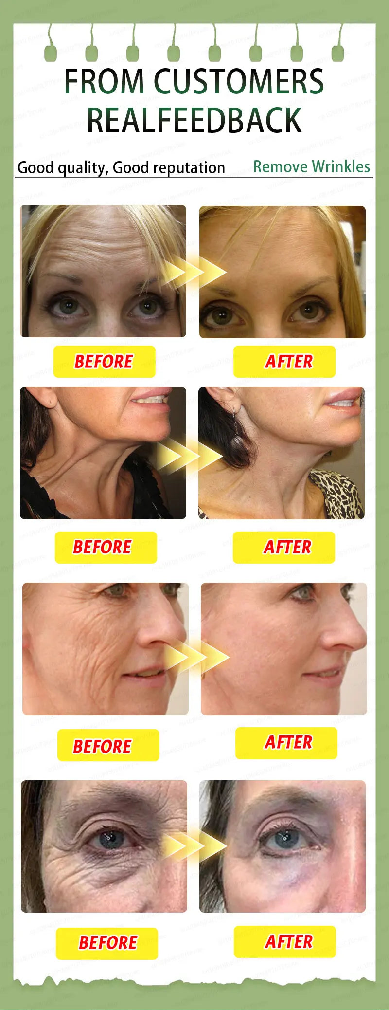 Wrinkle Hitman 100X — Liquid Anti-Aging Serum for Eyes, Face & Neck (Hollywood-Grade Formula)