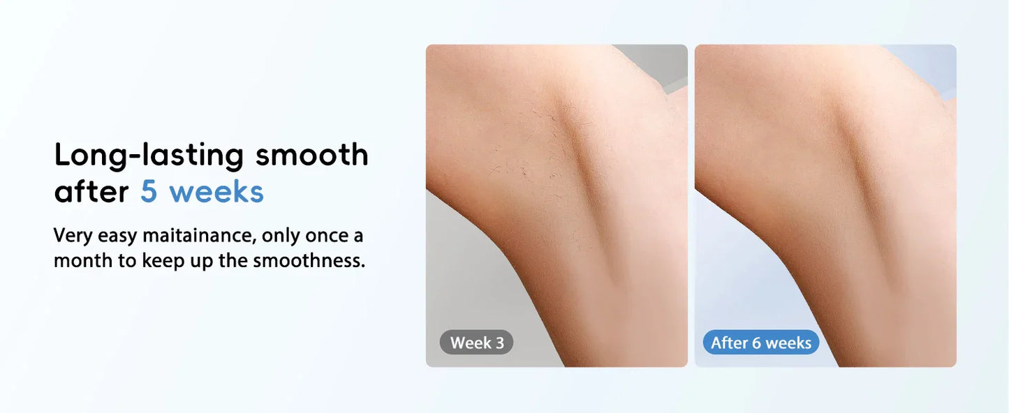 FlashQueen 5.2 – Unlimited IPL Laser Hair Removal Device with 22J Power & Lightning-Fast 0.8s Flashes for Face, Bikini & Body