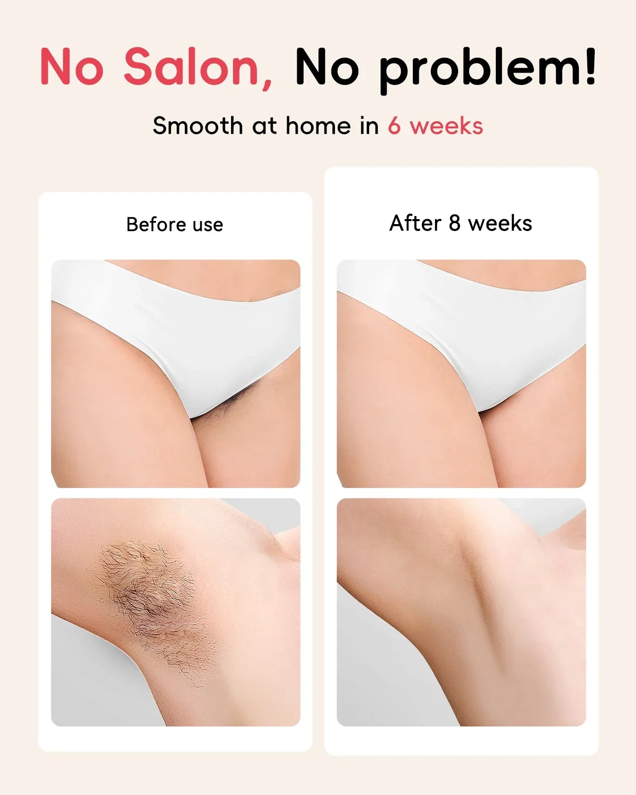 FlashQueen 5.2 – Unlimited IPL Laser Hair Removal Device with 22J Power & Lightning-Fast 0.8s Flashes for Face, Bikini & Body